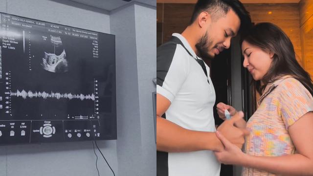 Jessica Mila Umumkan Kehamilan