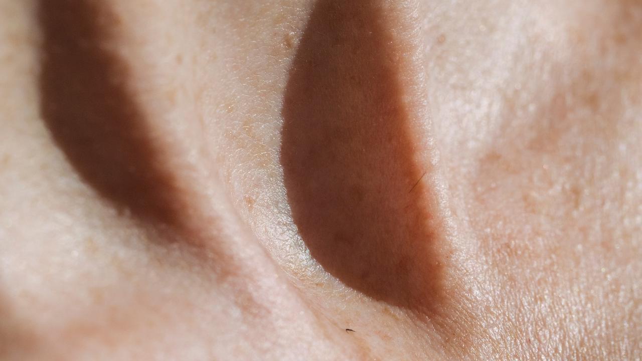 Waspada! Gatal-Gatal Belum Tentu Gejala Diabetes, Ini Penyebab dan Cara Membedakannya