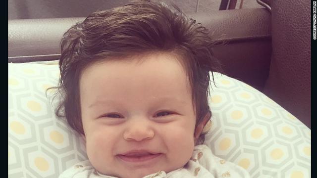 Foto Rambut Tebal Bayi 2 Bulan Ini Jadi Viral Global Liputan6 Com