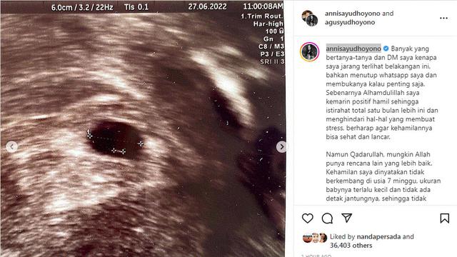 Annisa Yudhoyono alami keguguran