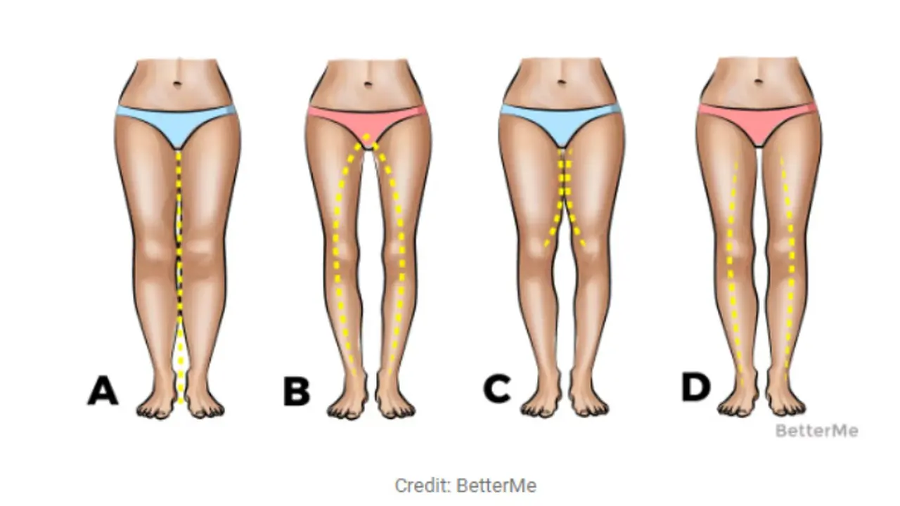 Ladies, 5 Bentuk Kaki Ini Bisa Jabarkan Kepribadianmu