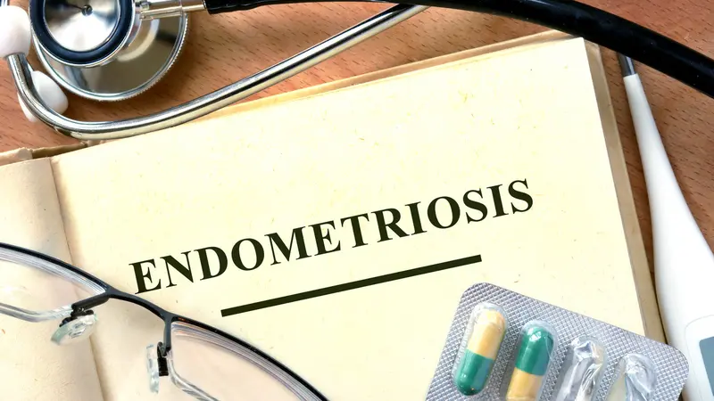 Endometriosis (iStockphoto)