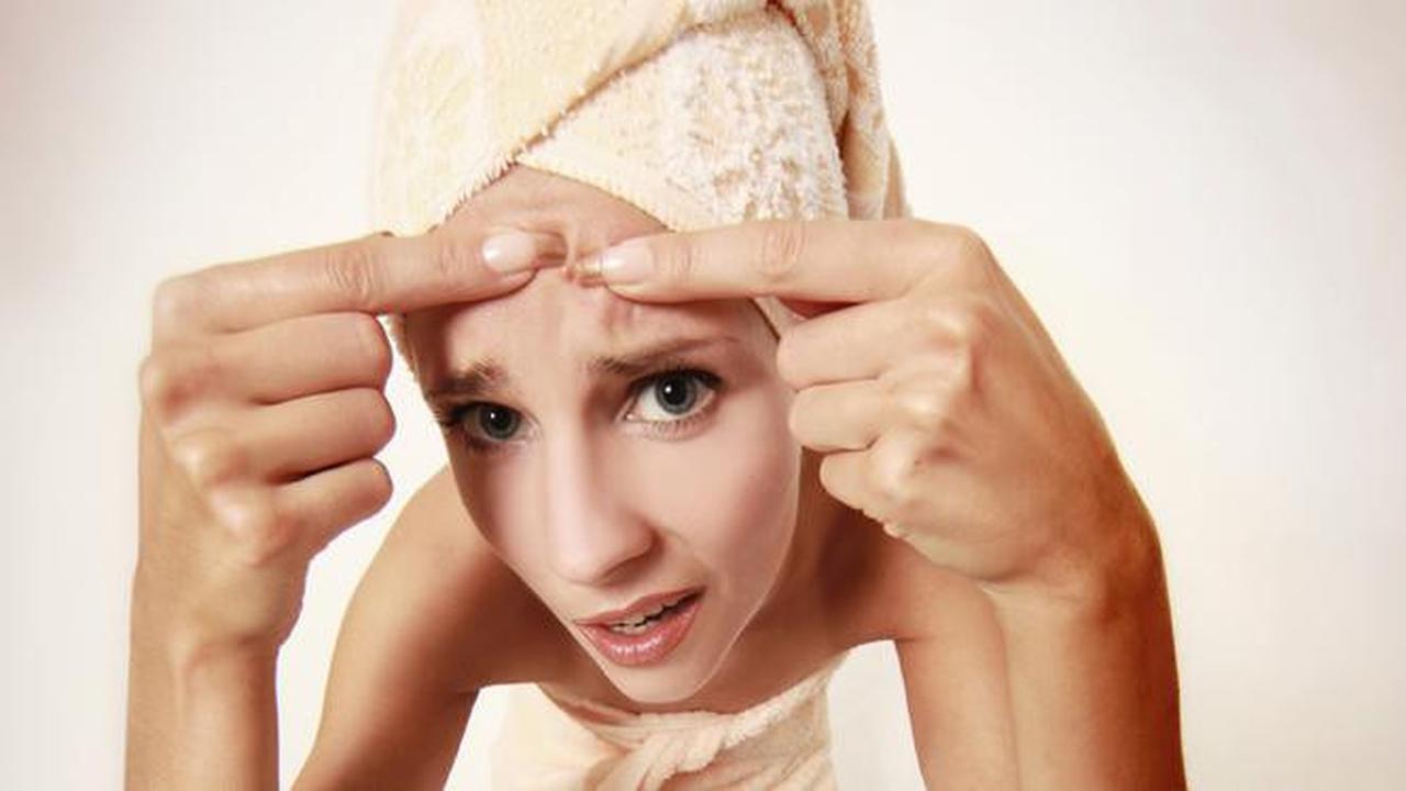 Ingin Jerawat Cepat Hilang? Minum Teh Herbal Ini