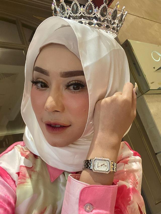 Berhijab Usai Sakit Aneh, Ini 6 Potret Gaya Terbaru Baby Sexyola