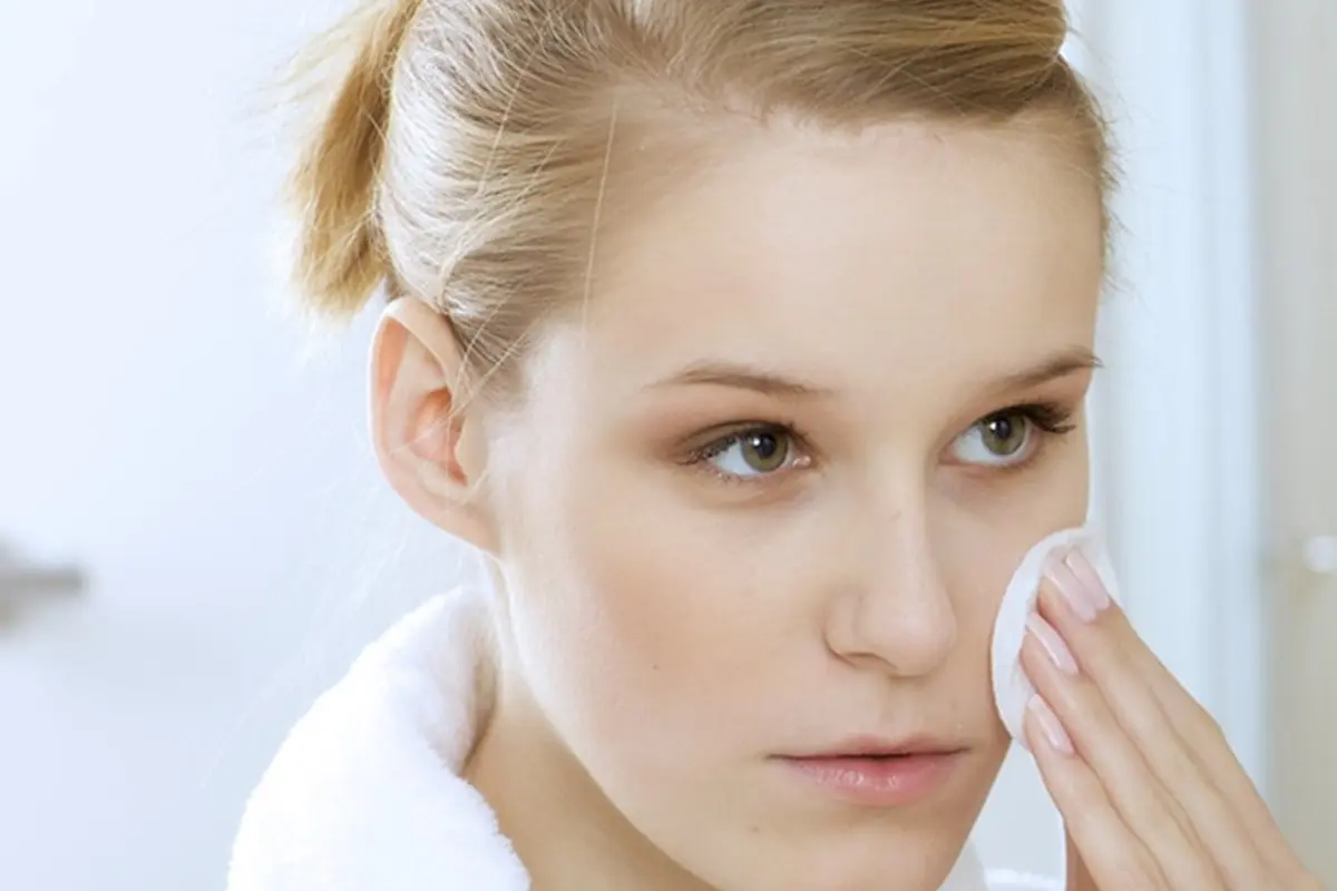 Cara mengatasi jerawat untuk kulit sensitif / Image: Shutterstock