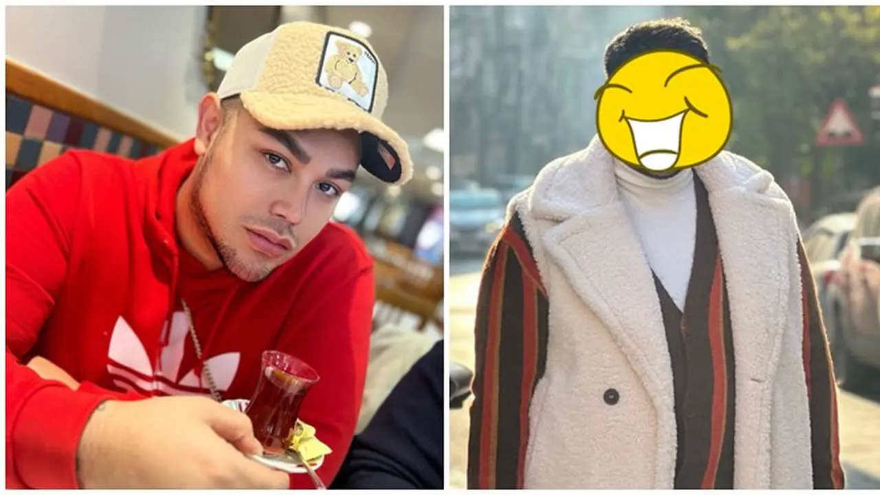 Sekalian Berlibur, Ini 7 Potret Ivan Gunawan Jalani Operasi Hidung di Turki