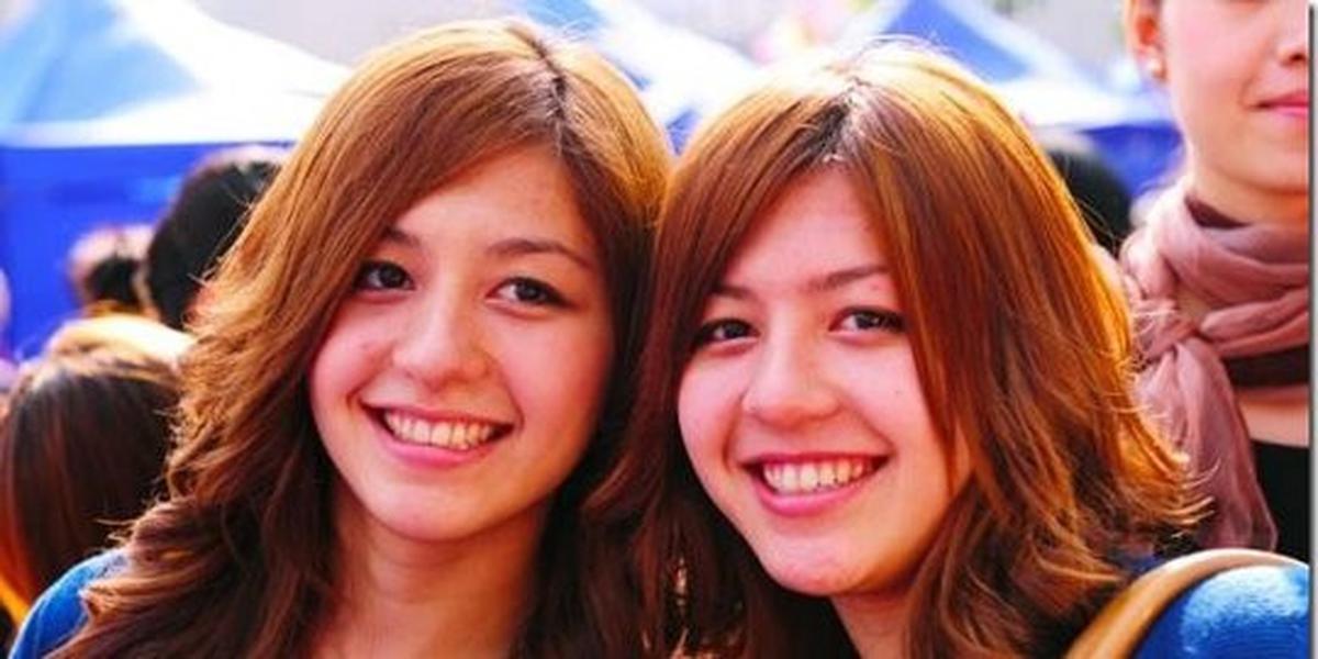 Gadis kembar China kompak barengan ganti kelamin