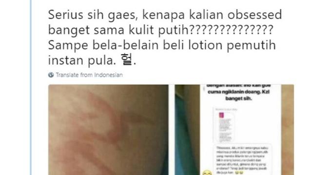 hati-hati jika pakai lotion pemutih (brilio/twitter @nuruliu)