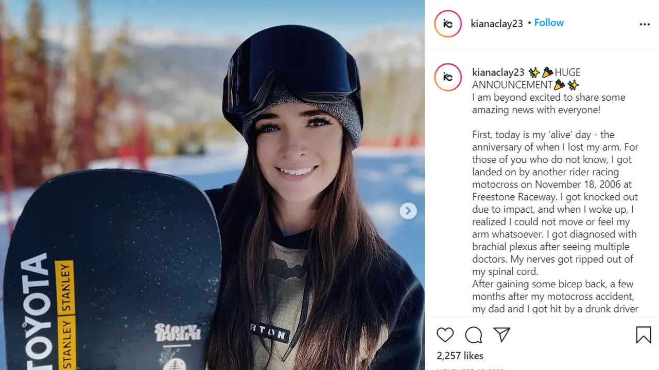 Kiana Clay