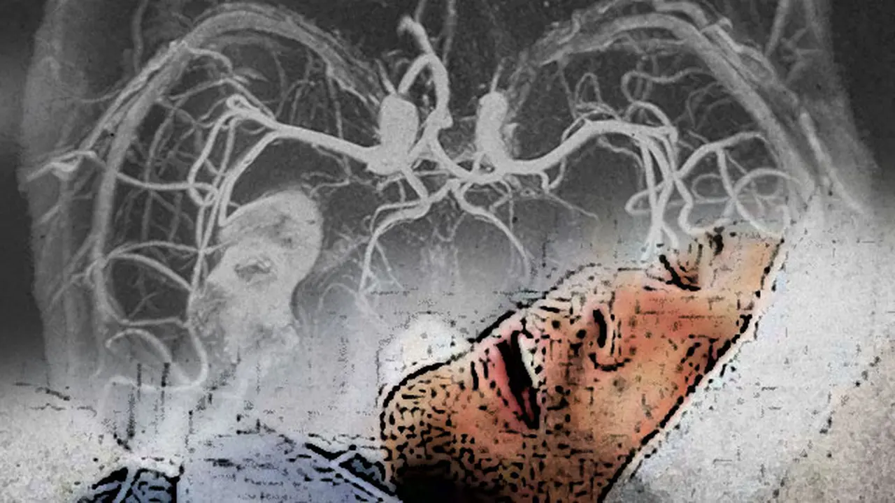 Ilustrasi Stroke 3 (Liputan6.com/M.Iqbal)