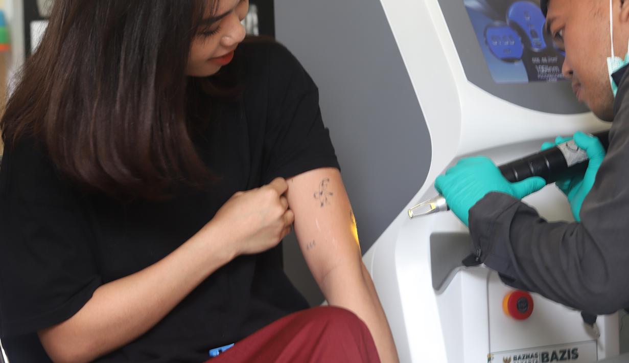 Pihak Baznas/Bazis DKI Jakarta menegaskan bahwa proses menghapus tato jauh lebih sulit dibandingkan saat membuatnya. Tampak dalam foto, petugas melakukan proses hapus tato pada tubuh peserta di Masjid Sunda Kelapa, Jakarta, Selasa (24/2/2026). (merdeka.com/Arie Basuki)