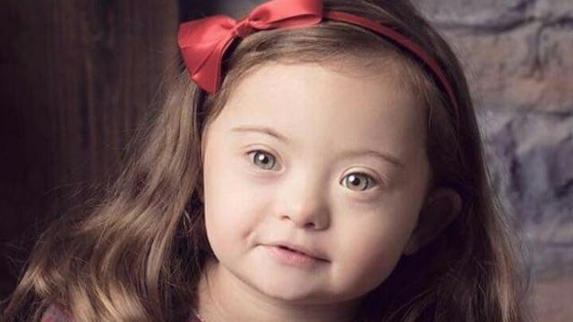 Francesca Rausi Model Down Syndrome Berusia 4 Tahun Yang