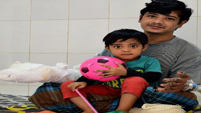 Abul Bajandar Manusia Pohon