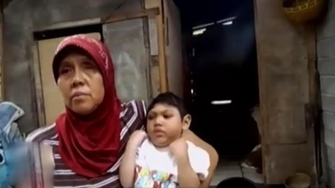 VIDEO: Bocah Kekurangan Gizi di Lombok Ini Menanti Bantuan