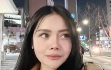 Mawar AFI Oplas Hidung Lagi Implan Pakai Tulang Iga, Ini Potretnya