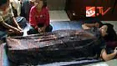 Tuti kerap mengeluhkan sakit perut yang hebat. Ternyata terdapat paku dan silet dalam rahim warga Padang Lawas Utara, Sumut, itu. 