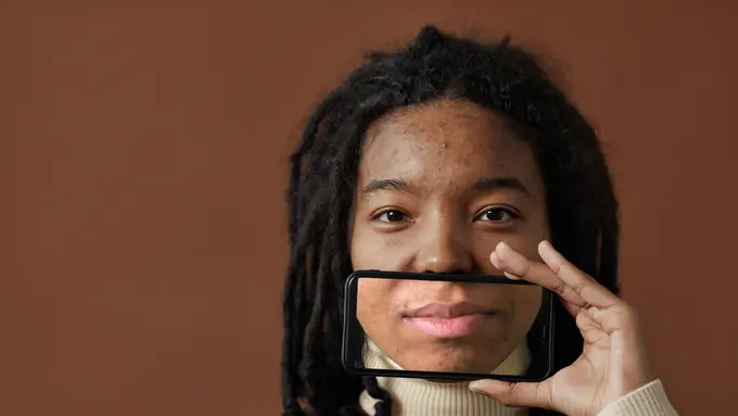 Inilah Penyebab Kemunculan Jerawat di Wajah Berdasarkan Letaknya