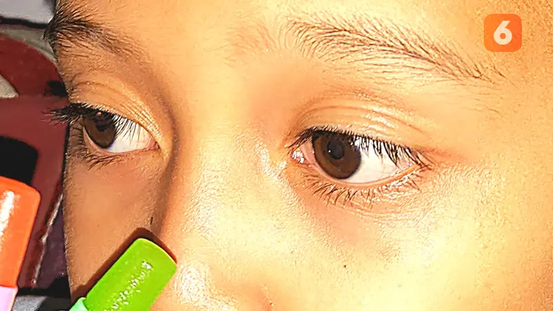 5 Gangguan Retina Mata yang Bisa Picu Disabilitas Netra, Simak Cara Mencegahnya
