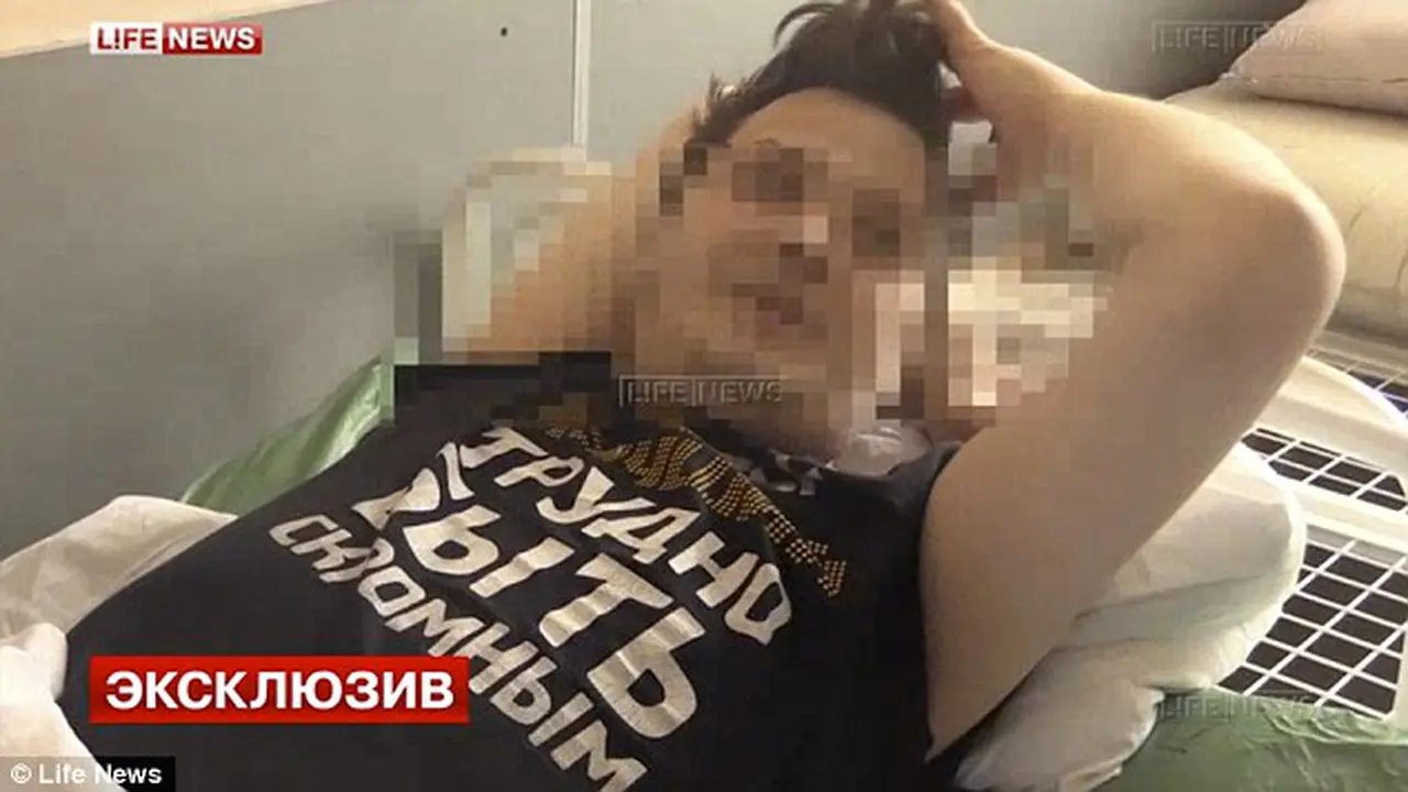 Sadar dari Obat Bius, Aktor Rusia Kehilangan Testisnya