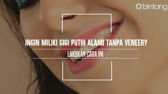 Ingin Miliki Gigi Putih Alami Tanpa Veneer? Lakukan Cara Ini