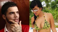 Diego Michiels Ingin Biayai Semua Pengobatan Jupe di Luar Negeri