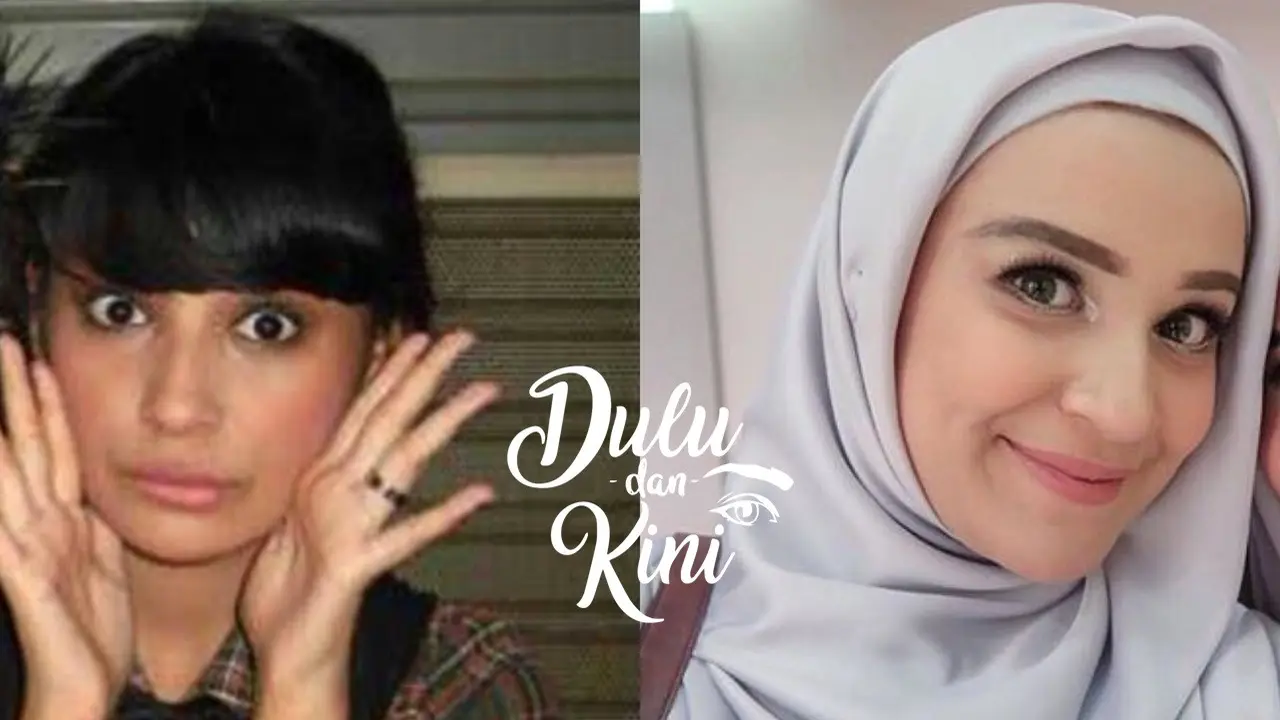 Dulu dan Kini: Transformasi Shireen Sungkar Semakin Feminin dengan Hijab