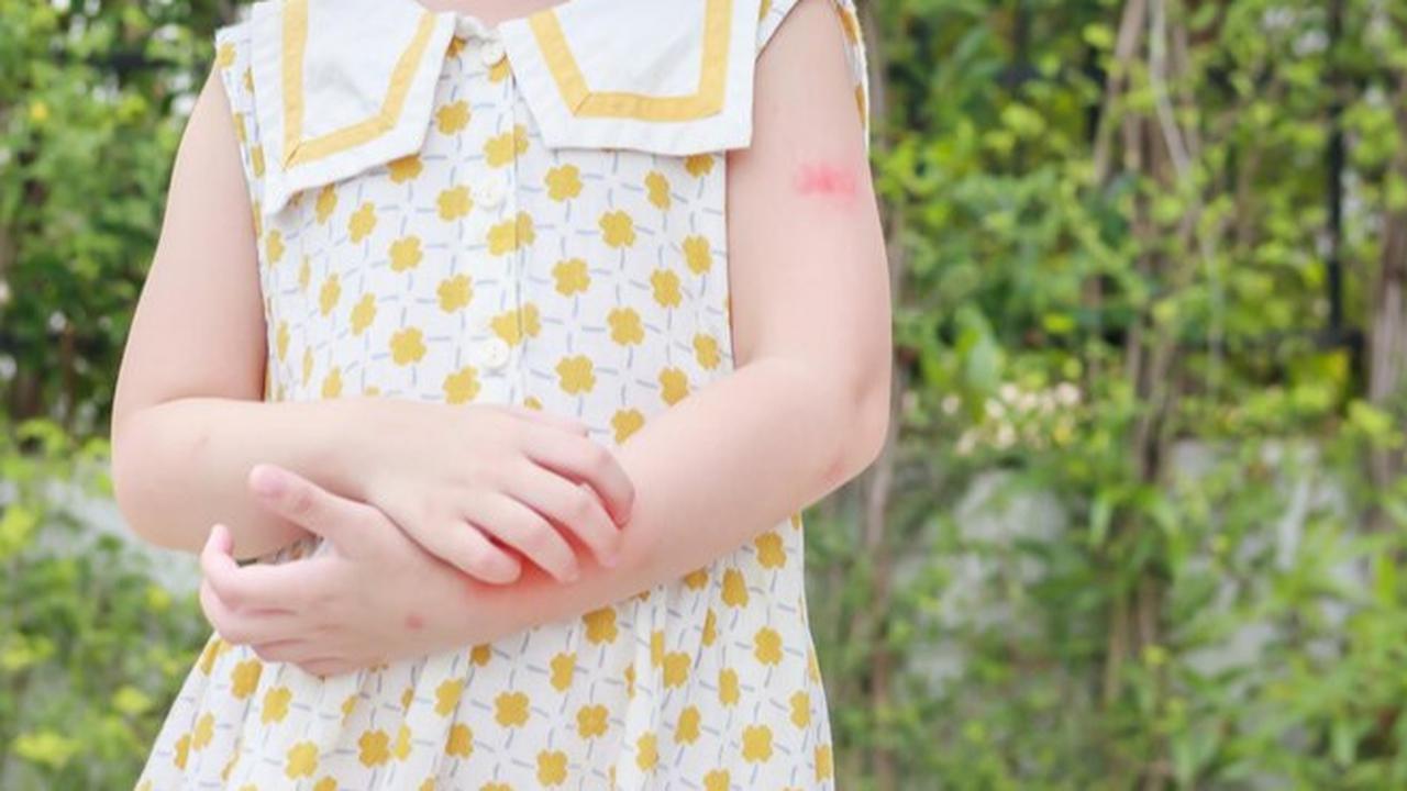 Kenali 5 Kondisi Kulit Umum pada Bayi dan Anak-Anak Serta Cara Menanganinya