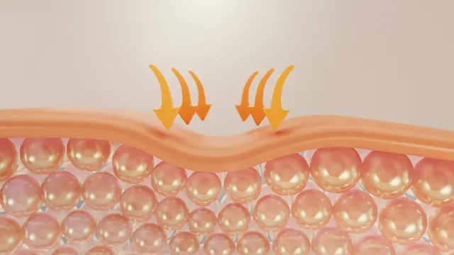 Skin barrier sebagai lapisan pelindung pertama pada kulit