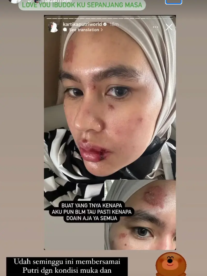 Unggahan Kartika Putri. (Foto: Dok. Instagram @kartikaputriworld)