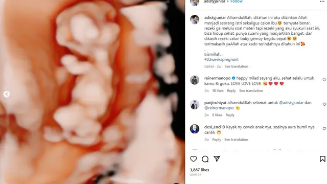 Potret Reiner Manopo dan Adisty Juniar Umumkan Kehamilan, Masuki Trimester Ketiga