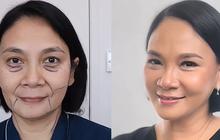 Potret Wajah Dian Nitami Sebulan Pasca Face Lifting: Kulit Kencang dan Hasil Natural