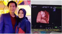 Cut Meyriska periksa kehamilan pakai USG, wajah bayinya curi perhatian. (Sumber: Instagram/@cutratumeyriska/YouTube/RogerChika Journey)