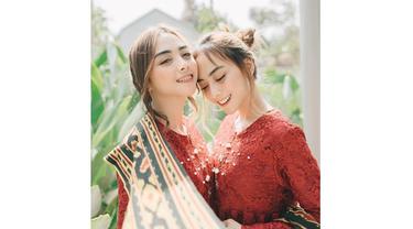 Selebgram asal Bandung ini terlihat sangat identik membuat siapa pun bingung membedakan keduanya.