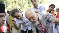 Kenali Ciri-Ciri Kusta, Segera Obati agar Bisa Sembuh Total