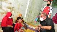 Langkah Cepat Gubernur Sumut Edy Rahmayadi Tangani 2 Anak Penderita Penyakit Kulit
