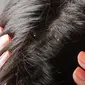 Garam dapat digunakan untuk mengurangi ketombe di area rambut yang ada di kepala