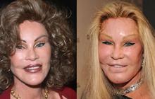 Jocelyn Wildenstein 'Catwoman', Sosialita Asal Swiss Sekaligus Penggila Operasi Plastik Dikabarkan Meninggal Dunia