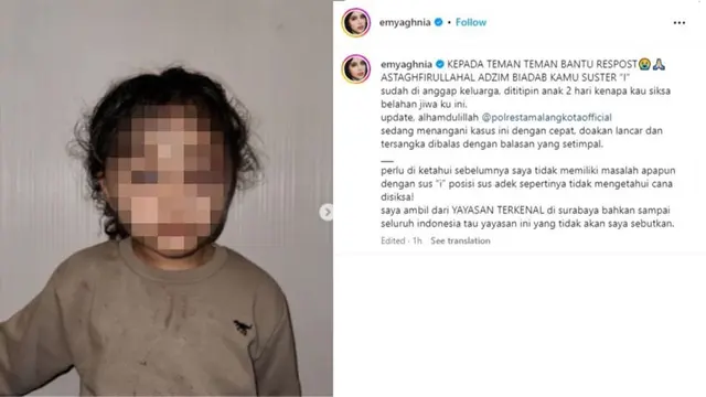 Anak Emy Aghnia menjadi korban kekerasan suster pengasuhnya. (instagram/emyaghnia)