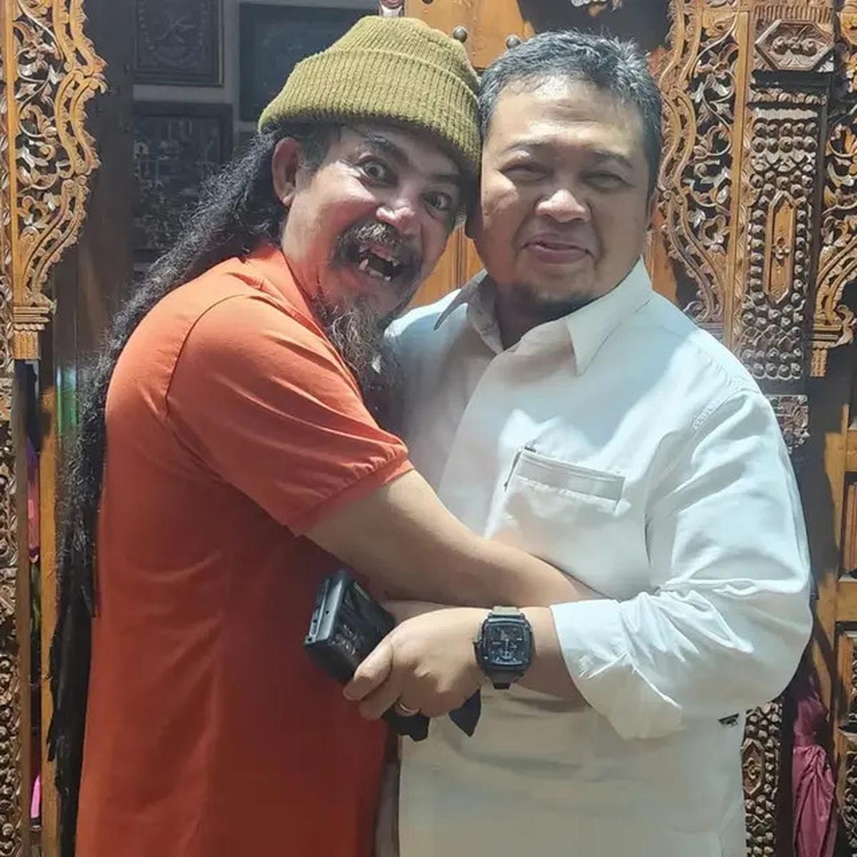 Intip Potret Limbad Pamer Gigi Taring yang Nyentrik, Ceritanya saat Umrah Viral