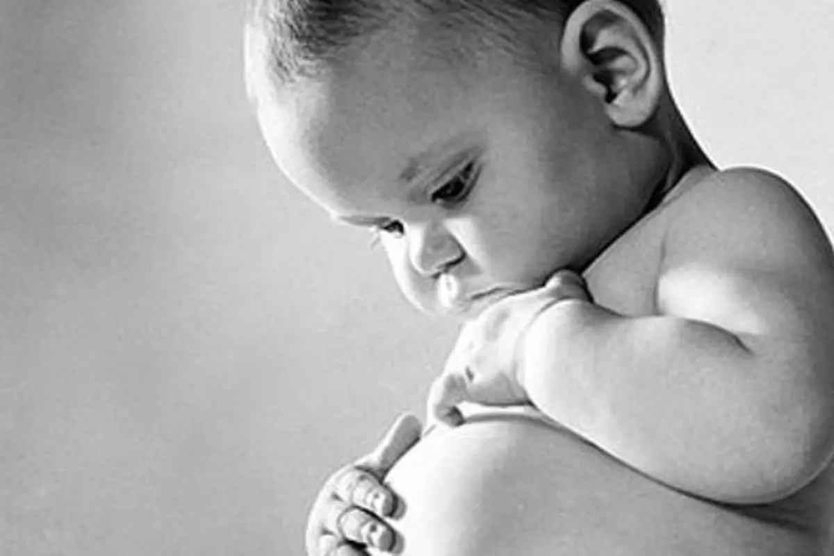 Menakjubkan! Bayi Perempuan Ini Mengandung Saudara Kembarnya