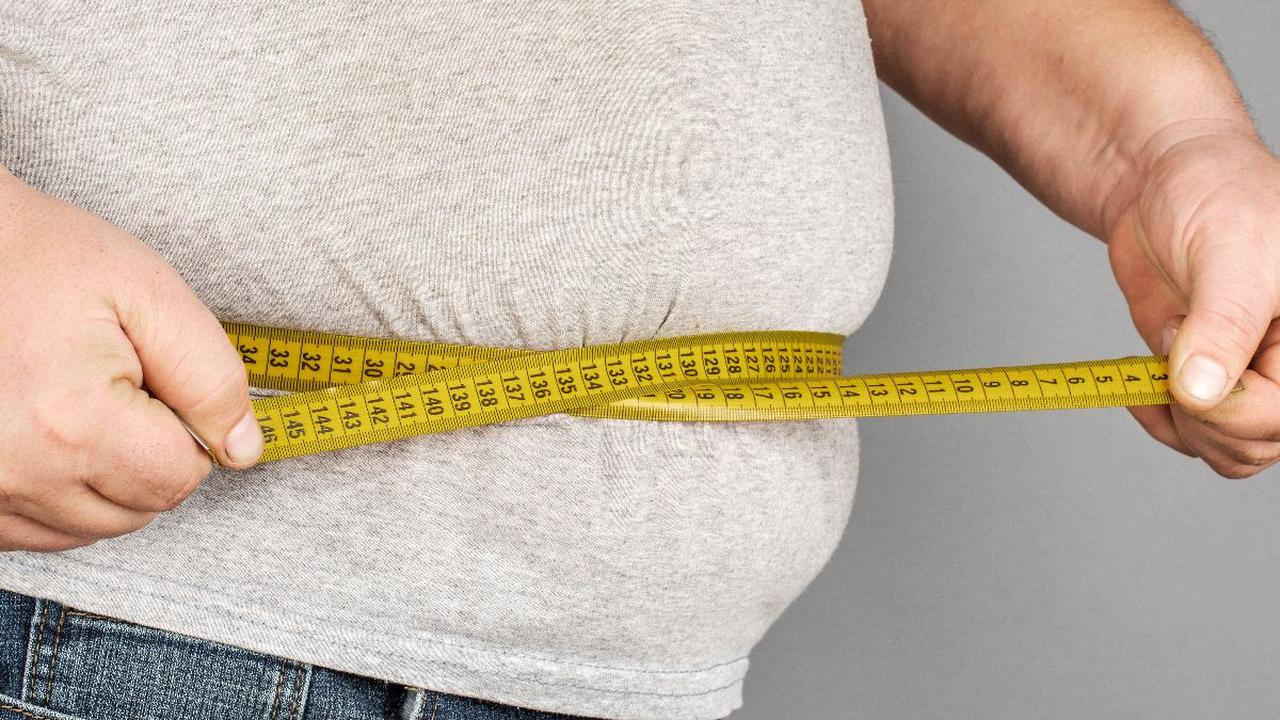 Obesitas