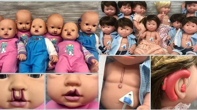 Ibu Ini Desain Boneka Inklusif untuk Anak Disabilitas, Hasilnya Menakjubkan