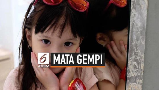 VIDEO: Masih 4 Tahun, Mata Gempi Minus dan Silinder