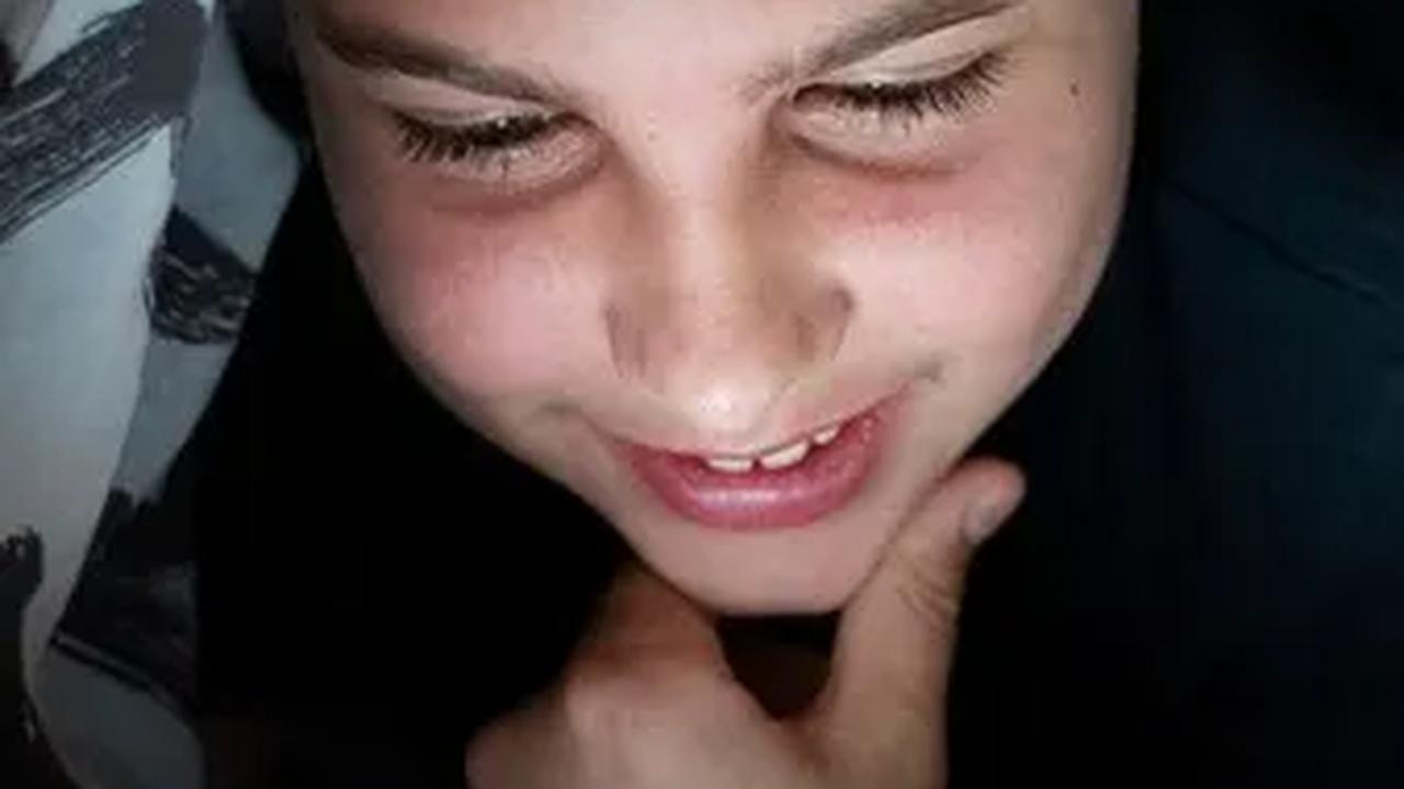 5.&nbsp;Obesitas