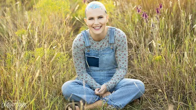 [Bintang] Anak Mengalami Kebotakan, Ibu Ini Lakukan Hal yang Luar Biasa untuk Menyemangatinya