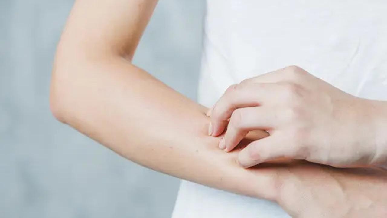 Bagus untuk Diet, Ini 5 Manfaat Minum Air Putih saat Perut Kosong