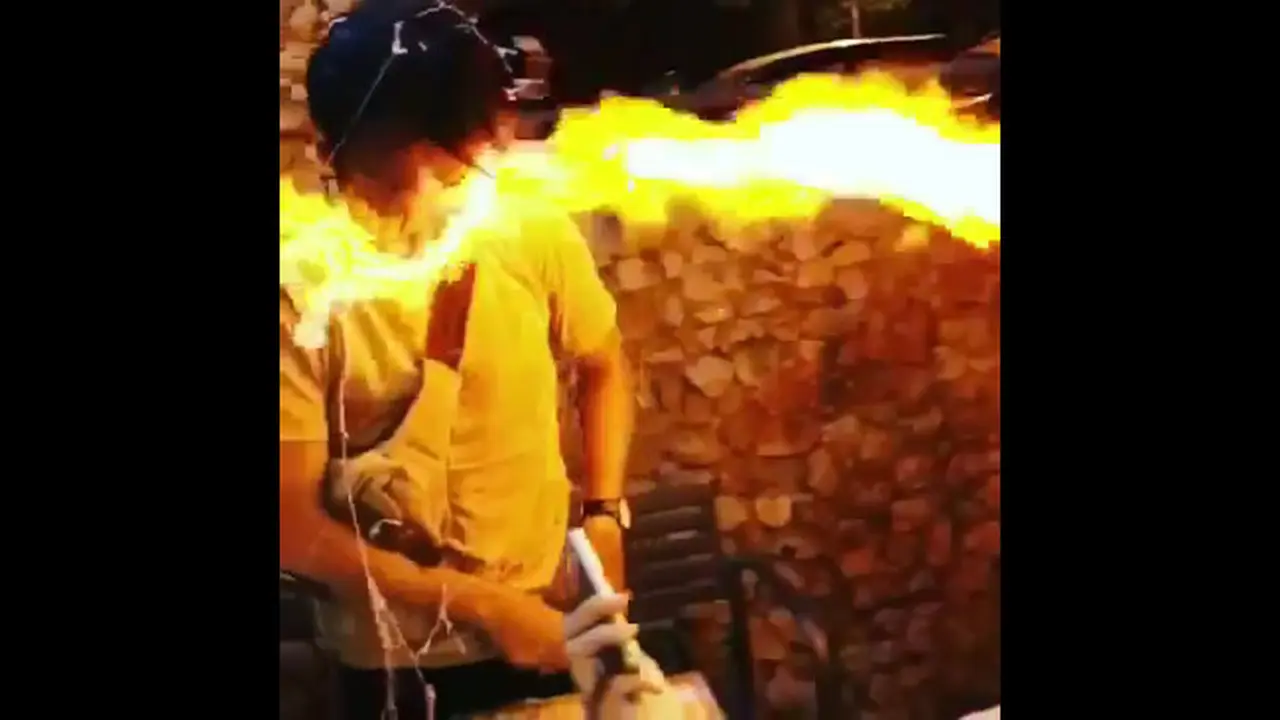 Kejutan Ultah Berujung Petaka, Mainan Ini Bakar Tubuh Korban