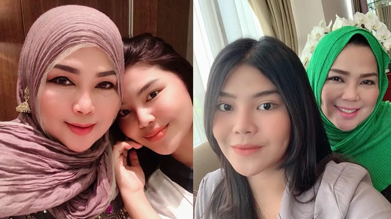 Bak Pinang di Belah Dua, Ini 6 Potret Rosa Meldianti dan Ibunda