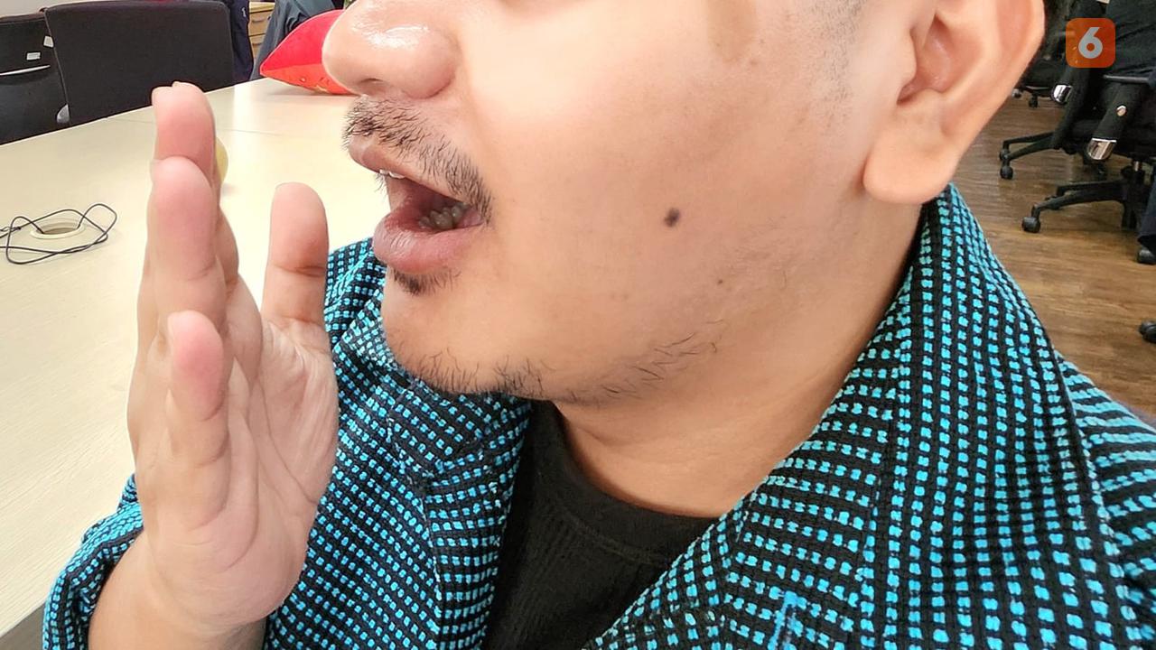 11 Cara Jaga Kesehatan Gigi dan Mulut Saat Jalankan Puasa Ramadhan