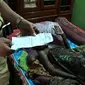 Kasturi, warga Desa Bulusari, Kecamatan Bulakamba, Brebes, Jateng, menderita penyakit tak biasa karena di sekujur tubuhnya tiba-tiba melepuh. (Liputan6.com/Fajar Eko Nugroho)